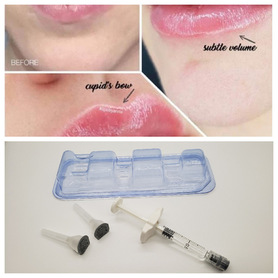 2 ml wypełniacza skórnego o wysokim stężeniu Ha 24 mg/ ml