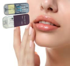 2 X 1 ml Juvederm Ultra 4 Wstrzykiwacz wypełniacz skórny Wstrzykiwacz wypełniacz warg