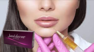 Juvederm Ultra 3 kwas hialuronowy HA wypełniacz skórny 2 ml