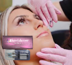 CE Wypełniacze warg kwasu hialuronowego 24 mg/ml Juvederm Nose Filler
