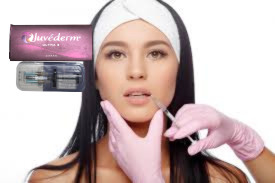 Juvederm Ultra 3 Ultra 4 Wypełniacz kwasu hialuronowego do wzmocnienia warg