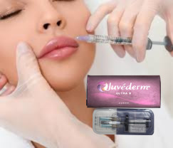 2 X 1 ml Juvederm Ultra 4 Wstrzykiwacz wypełniacz skórny Wstrzykiwacz wypełniacz warg