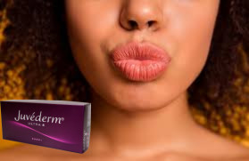 Juvederm Ultra 3 Ultra 4 Wypełniacz kwasu hialuronowego do wzmocnienia warg