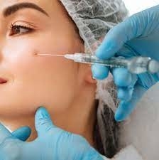 Gładkie zmarszczki Wstrzykiwacz do wypełniania skóry Kwas hialuronowy Juvederm Ultra 3 2*1 ml